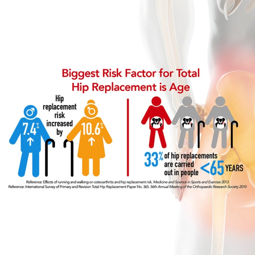 Hip Replacement - Who Has Hip Replacement Surgery?