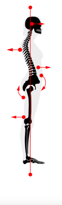 What Posture Are You The Putney Clinic Of Physical Therapy
