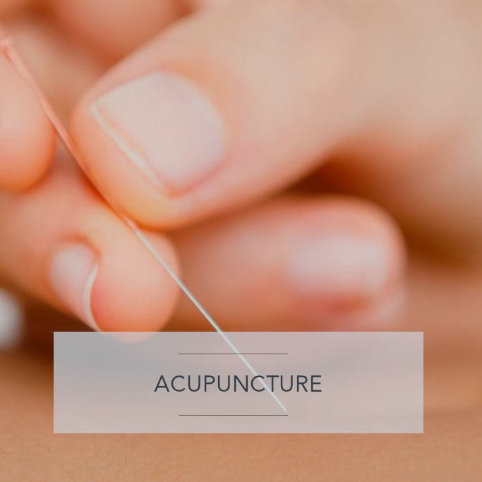 Acupuncture services